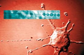 למעלה: קרום תא מלאכותי המעוצב כמחרוזת פנינים. למטה: תא שהשלד התאי שלו מטופל בחומרים מפרקים, משנה את צורתו ויוצר את תצורת הפנינים